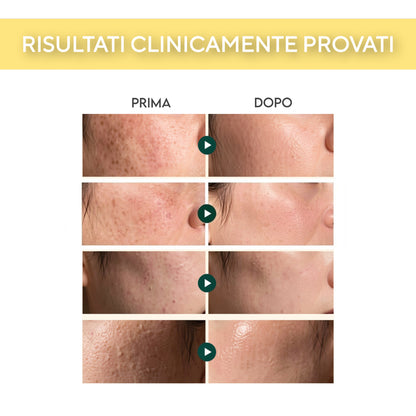Crema Capsule Vitamina C
